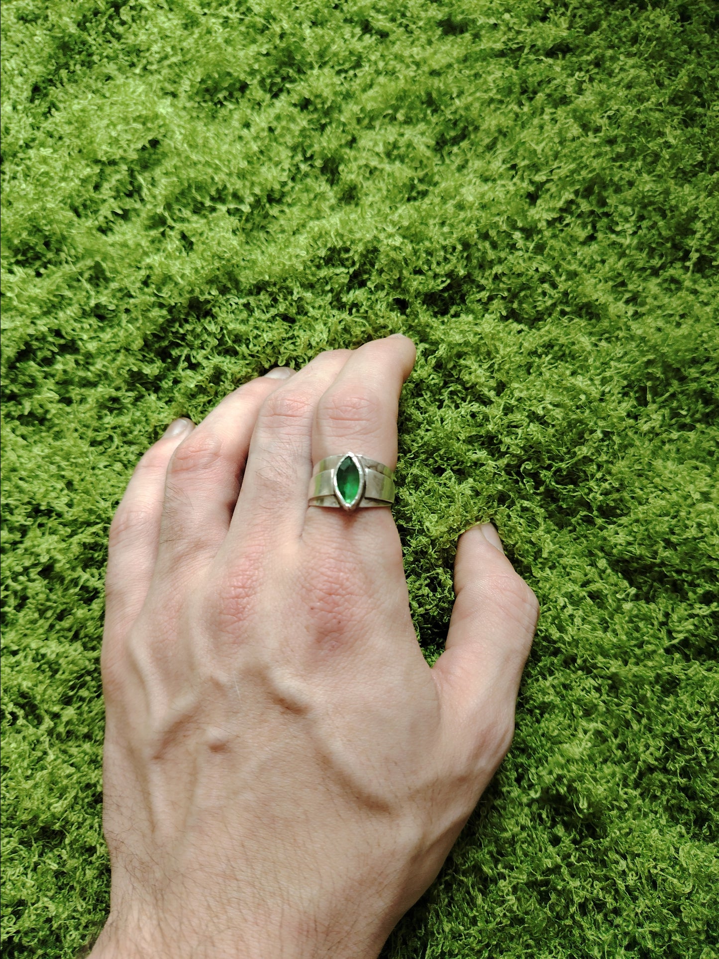 ANELLO RADURA